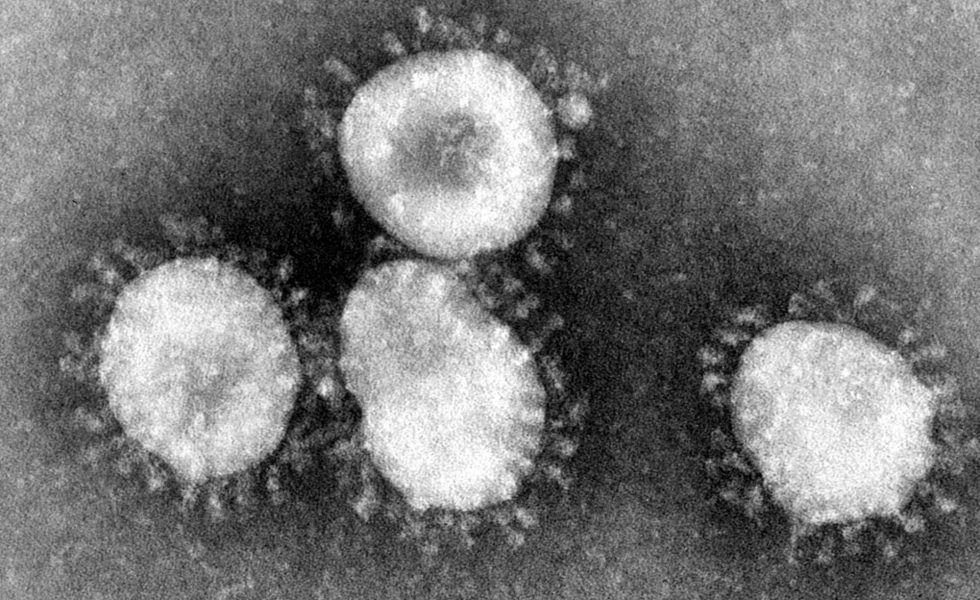 Imagem ao microscópio eletrônico de quatro coronavírus. Aparecem como quatro círculos sólidos e claros, completamente margeados por pequenas manchas claras como se fossem pequenas flores com grandes miolos e pétalas pequenas.