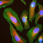 hela cells stained with antibody to actin green vimentin red dna blue 150x150 - (Português do Brasil) Ciência POP #3 (V.3, N.4, P.2, 2020)
