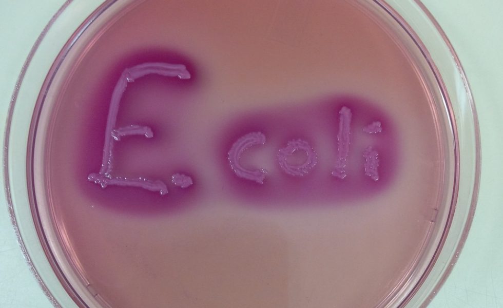A imagem mostra dois círculos representando a vidraria placa de Petri utilizada em laboratório. A parte interna dos círculos está preenchida pela cor rosa degradê que é o meio de cultivo. Na parte central observa-se o escrito E. coli onde está crescendo a própria bactéria.