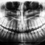 teeth 150x150 - Why do people feel pleasure in pain? (V.4, N.3, P.1, 2021)
