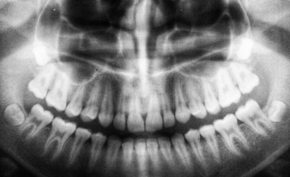 Radiografia da região da boca, porção anterior dos ossos maxilares e mandíbula - face frontal. Nela é possível ver a dentição permanente de um indivíduo adulto.