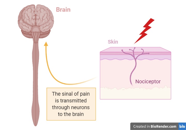 nociceptor en 1 - Why do people feel pleasure in pain? (V.4, N.3, P.1, 2021)